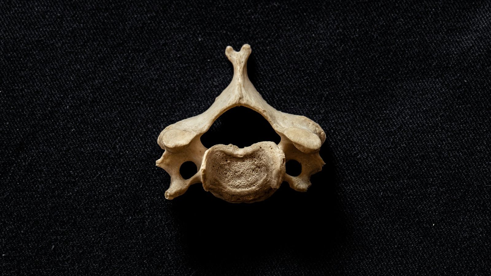 Printing the Future: How 3D Models Are Shaping Healthcare Training in Kenya